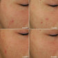 Blemish + Age Defy Routine Light