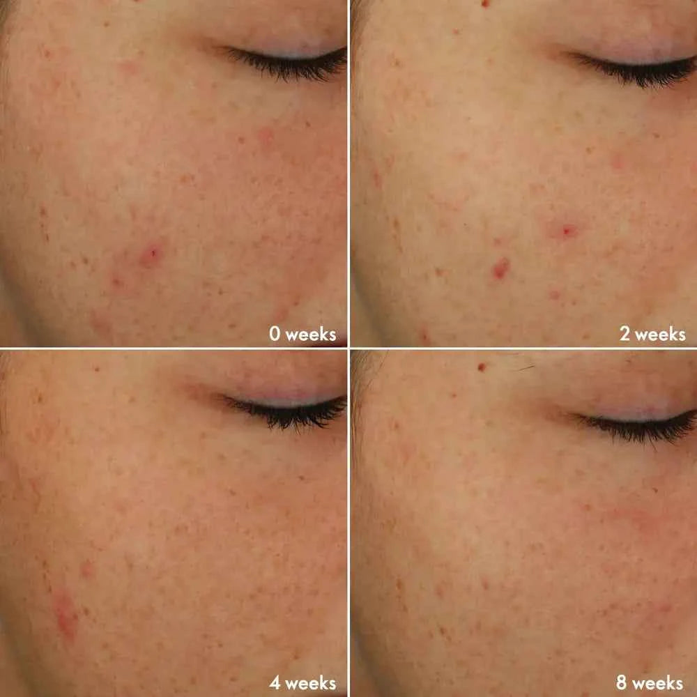 Blemish + Age Defy Routine Light